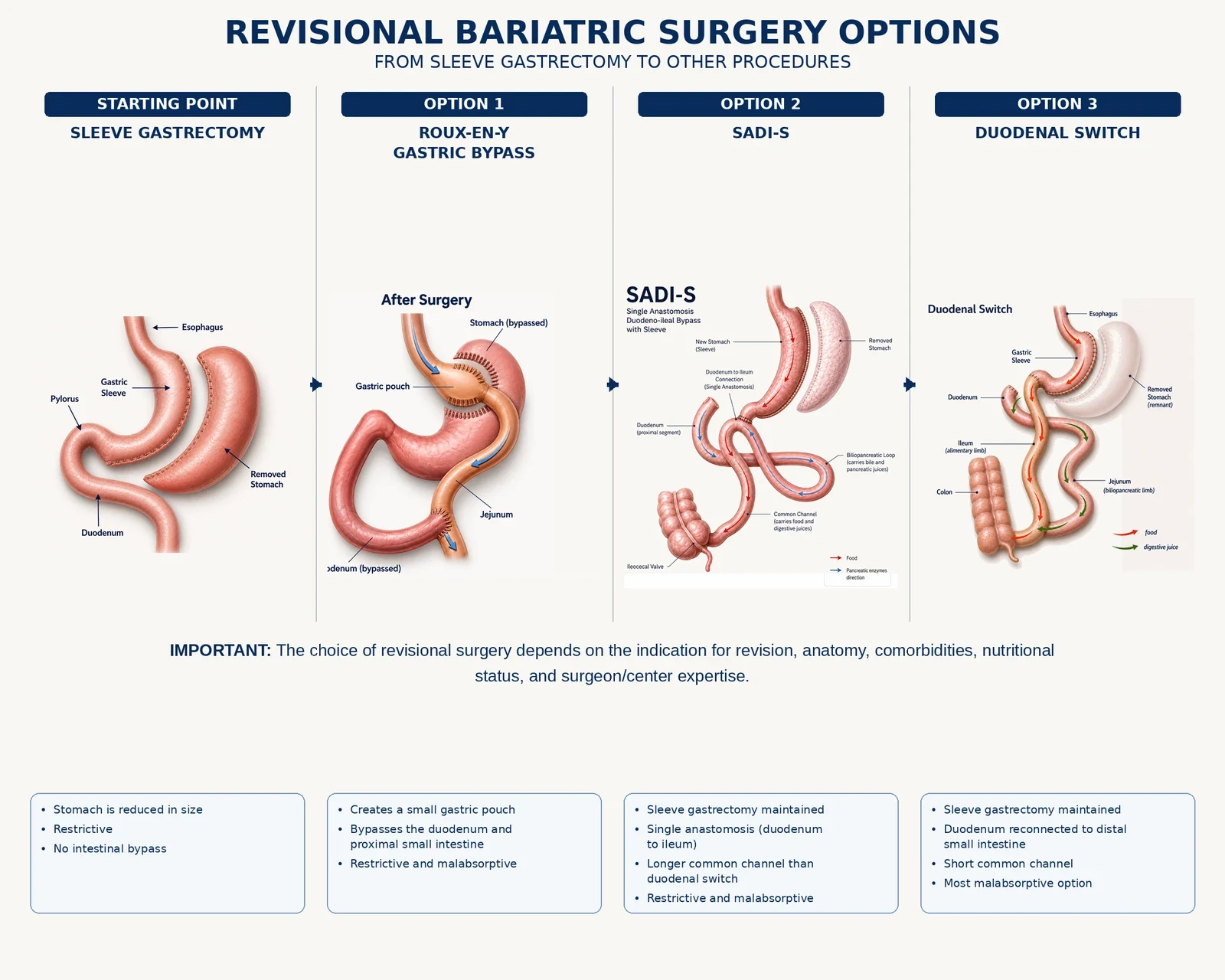 Revisional bariatric surgery options: from sleeve gastrectomy to gastric bypass, SADI-S, or duodenal switch, with what each procedure changes